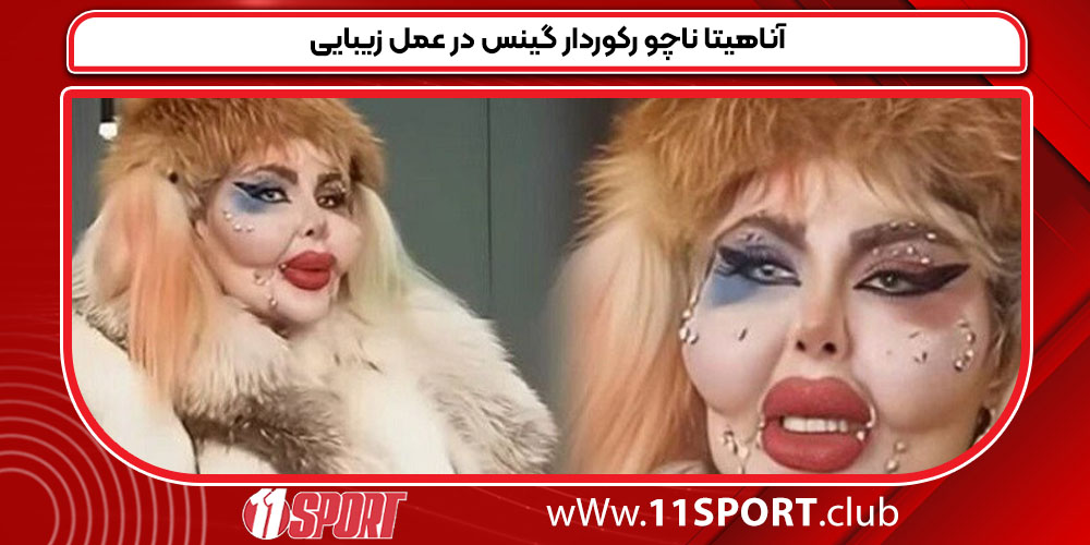 آناهیتا ناچو رکوردار گینس در عمل زیبایی آناهیتا ناچو رکوردار گینس در عمل زیبایی