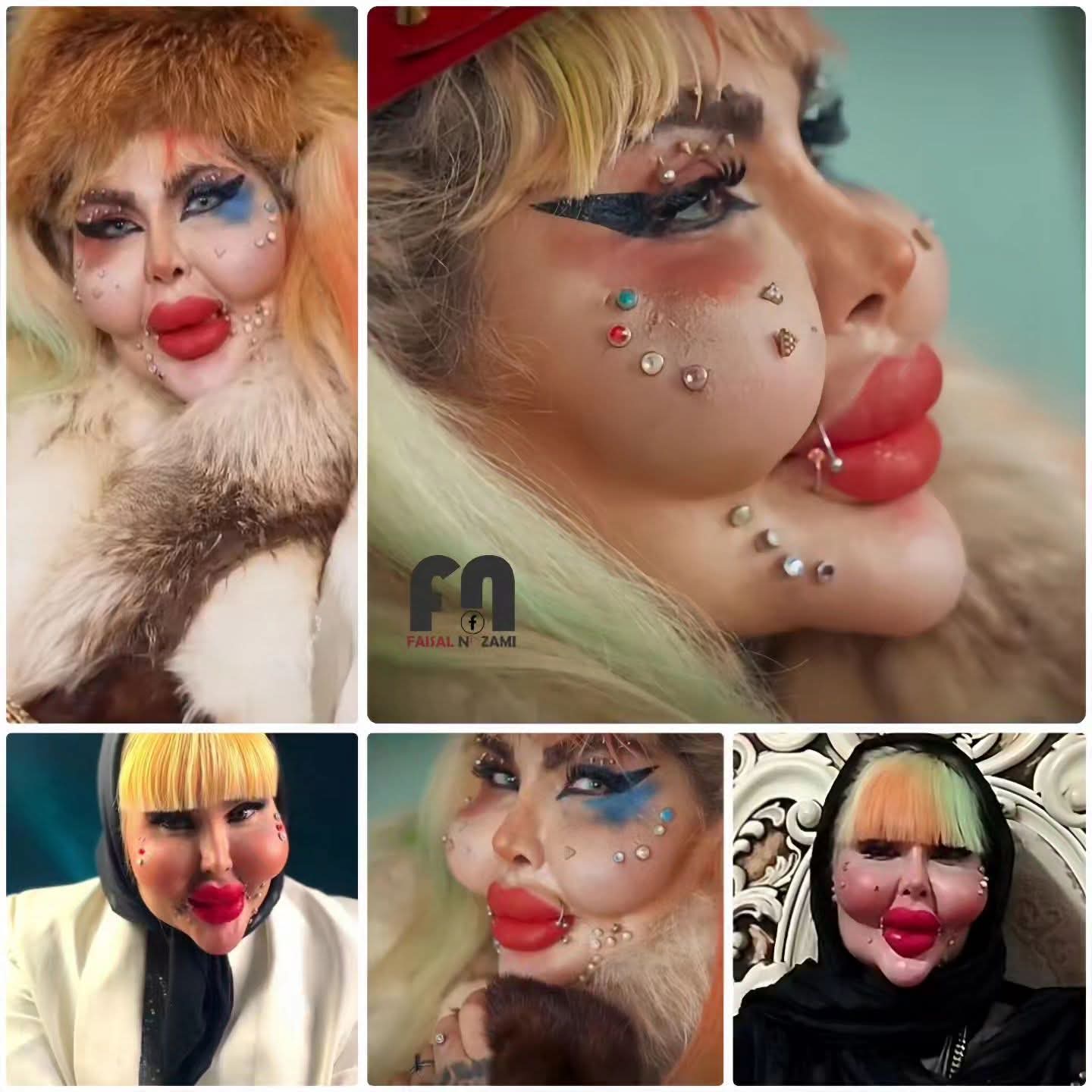 آناهیتا ناچو با ۳۸۸ عمل جراحی زیبایی آناهیتا ناچو با ۳۸۸ عمل جراحی زیبایی